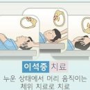 이석증 치료법 자가치료 이석증 원인 증상 자가진단 이미지