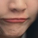 사적인아름다움 지유의원 네이버블로그