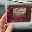 양산밝은안과의원 이미지