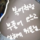 생식기에서 뽀글뽀글거리면서 게거품이 나고, 계란 흰자처럼 끈적거리는 분비물이 나옴. 이미지