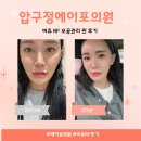 에이포의원 이미지