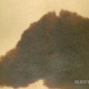 몽고반점 이미지