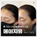 더 부띠끄 강남점 | 강남 헤어라인 반영구 잘하는 곳 '메이지유 부띠끄 강남점' 상세후기 및 통증