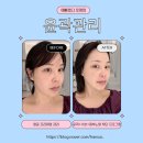 남양주 피부관리받고 예뻐졌다 호평점 윤곽관리 후기