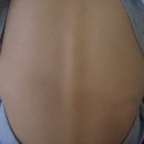 SNPE척추운동 이미지