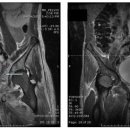 부인과 자기공명영상[pelvis magnetic resonance imaging, pelvis MRI] 이미지