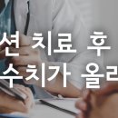 킬레이션 치료 후 오히려 중금속 수치가 올라갔다면 이미지