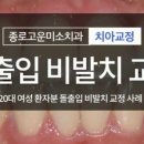 미소고운치과 - 광주시 고불로 44 | 미소고운치과