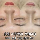 정하울뷰티샵 | 순천 피부 관리 정뷰티샵 미백 모공 진정 관리 후기