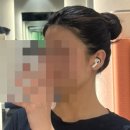 털보헤어플러스의원 | [미용] 전주 밴스의원 헤어라인 제모 1회차