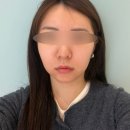 논현수의원 | 신논현 쁨의원 신논현 피부과 필로드2cc 후기 강남역피부과