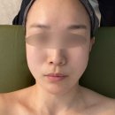더끌림샵(The 끌림 #) | 새솔동 피부관리 : 더샵끌림에서 유지인대리프팅관리 후기