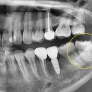 이아소치과의원 이미지