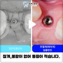 에이플란트치과의원 이미지