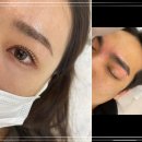 올케어 강남 네이버블로그