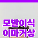 선헤어라인 이미지
