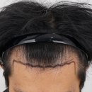 모모성형외과의원 이미지