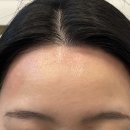 라미헤어라인