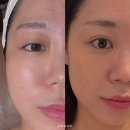 피부봐요 | 센텀 에스테틱 윤곽 피부관리 후기 무결 추천 이유