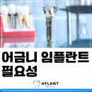 에이플란트치과의원 이미지