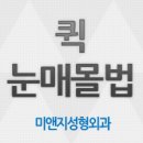 미앤지