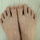 메디아트 | 인천 패디플래닝 내성발톱 고민 해결 리얼 대만족, 풀리메디 영종도점 꼼꼼 관리 후기