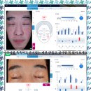 필밸런스의원 | 안산아쿠아필 촉촉하고 윤기있는 피부 만들고 싶다면 꼭 읽어 보세요