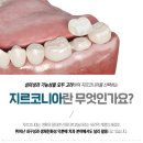 다산리더스치과의원 | 다산역치과 심미성과 강도를 모두 잡은 지르코니아 보철치료