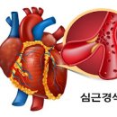 건강을 위한 최고의 선택 걷기 운동의 효과와 방법 이미지