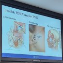 역곡열린치과의원 | 아시아턱관절학회 연수회 (feat. PDRN 턱관절 주사)