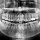 신플란트치과의원 이미지