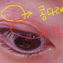 안동삼성연합안과의원 이미지