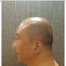 스킨 앤 바디 신의손 | 림프근막순환관리로 두피 변화 확인 서울 두피관리샵 스킨앤바디신의손 후기