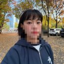 송약국 | 쌩무쌍의 자연유착 인라인 일주일 붓기 현황(하지말라는거 다한 쌍수후기...)