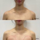 오르나페이스 | 군산 피부 바디관리 맛집 승모근보톡스 필요없는 오르나페이스