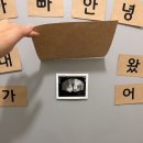 중문약국 | 난임기록8. 인천 서연 아이 시험관 비용 1차 만에 임신 성공 후기