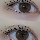 광광주유소 | 겉잡을 수 없는 뾰루지 탈출! 충주등드름 박살 내줄 찐친 소개