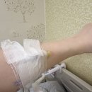 삼일프라자 | 순천현대여성아동병원 제왕절개 출산 3~5일차 퇴원 후기(태열, 황달, 심장초음파 등)