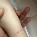 아주대학병원 | [14개월 아기] 4개월 대기 끝에 만난 아주대학병원 소아청소년과 ㅇㅅㅇ 교수님 교차진료 후기