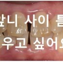 늘공감치과 이미지