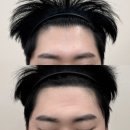 헤어로운날 | [건대/군자] 조이로운 | 남자 정수리 SMP 2-3회차 솔직 후기 ･ 만족도 추천