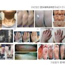 글로벌건강팜