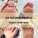 대구 서구) 문제성 발관리 받고 싶을 때는 '김혜진 네일&amp;풋시스' 강추해요! (발각질 솔직후기)