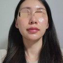 잠실나루역입구 | 잠실나루역 피부관리 리얼후기 스페셜 재생 플라즈마로 꿀광 피부 완성 더바른테라피