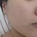 워시스퀘어 안성점 | 경기도 안성 신부관리 그날왁싱앤뷰티 저자극 세라링 3세대 스킨플래닝 주기,효과