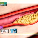 혈전/죽음의덩어리,화약고 이미지