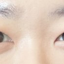 스마일 왁싱
