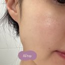［리뷰］피부진정크림 베르티 티트리 자일리톨 워터젯 크림 후기