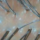 발머스한의원 이미지