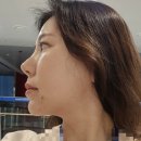 씨에스씨로렌의원 | csc로렌 온다리프팅 14만줄 통증, 효과 솔직 후기